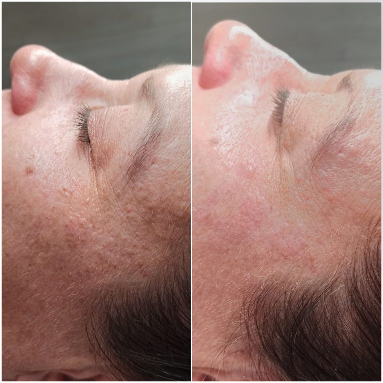 {"remix_data":[],"source_tags":[],"origin":"unknown","total_draw_time":0,"total_draw_actions":0,"layers_used":0,"brushes_used":0,"photos_added":0,"total_editor_actions":{},"tools_used":{},"is_sticker":false,"edited_since_last_sticker_save":false,"containsFTESticker":false}